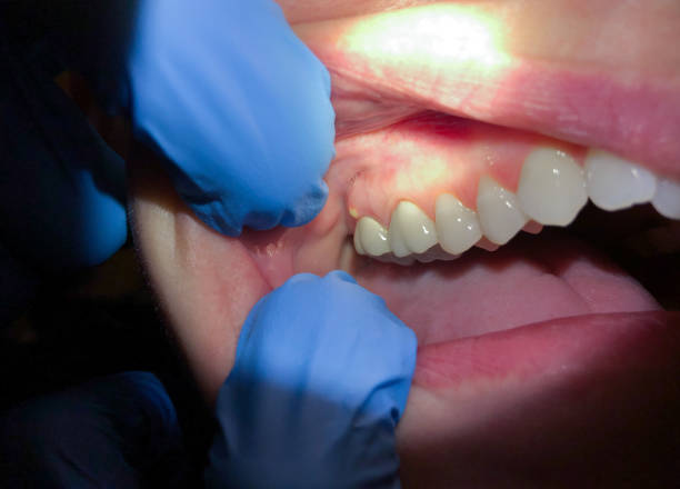 Best Pediatric Emergency Dentist in Butler, WI